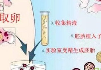 多囊卵巢做哪种运动好？什么样的运动适合多囊卵巢？
